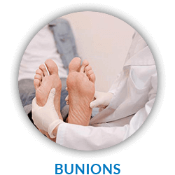 Bunions Treatment and Removal in Corsicana, Waxahachie & Ennis, TX