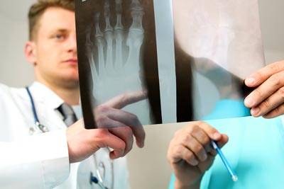 Can You Break an Ankle Without Realizing It?: Arlington/Mansfield Foot &  Ankle Centers: Podiatrists