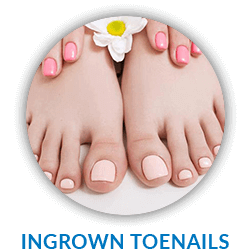 Ingrown Toenails Treatment in Corsicana, Waxahachie & Ennis, TX