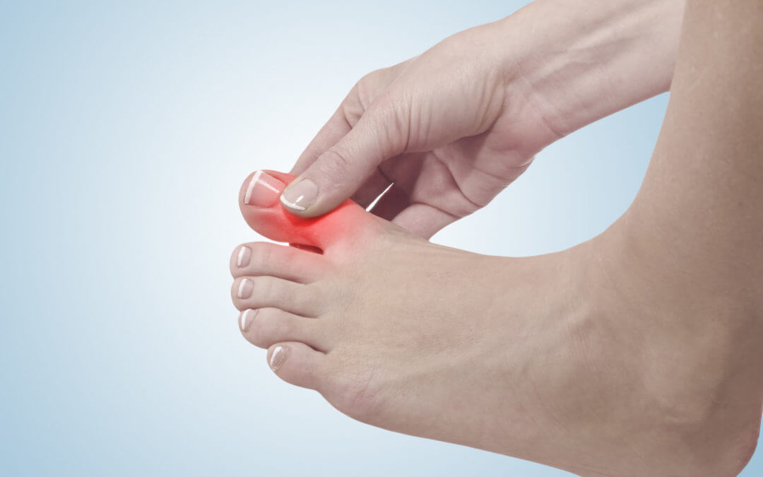 Know the Warning Signs: 5 Symptoms of Arthritis in the Toes