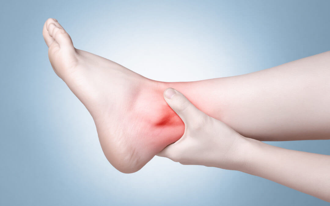 Stress Fractures in Ankles and Feet: Not Just for Athletes