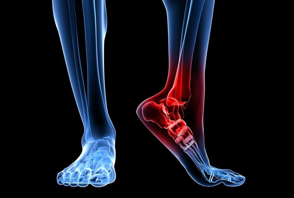 What Causes Heel Pain?