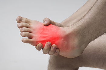 Causes of Stress Fractures