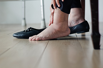 Common Elderly Foot Care Concerns
